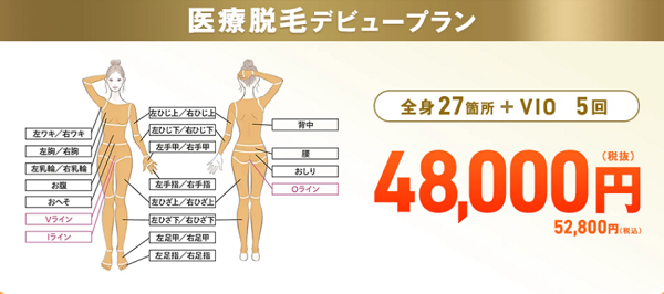 レジーナクリニックの全身27箇所とVIO医療脱毛プラン