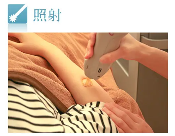 カルミア美肌クリニックの医療レーザー脱毛施術イメージ