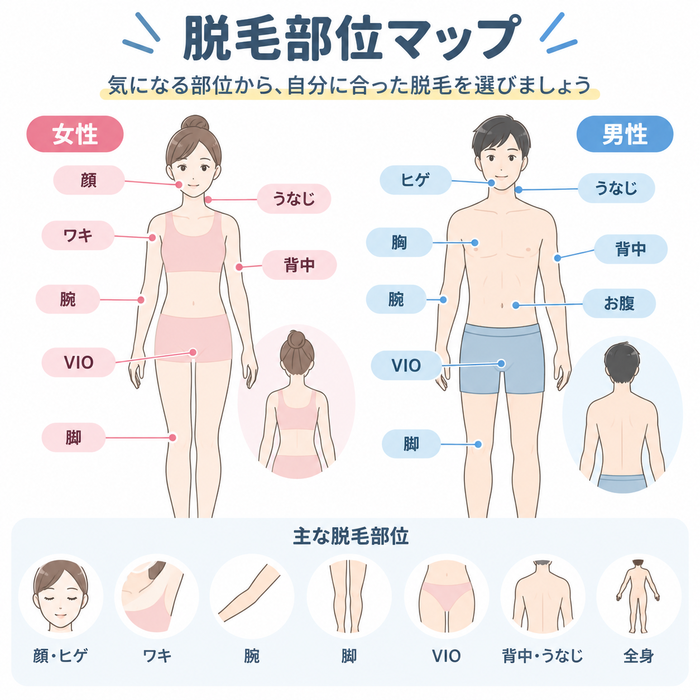脱毛部位マップ