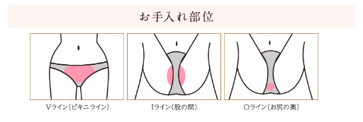 ディオーネのVIO脱毛範囲とデザインイメージ