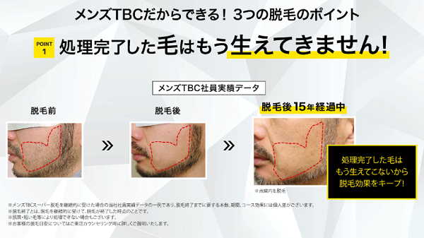 MEN’S TBCの男性向けカラダ脱毛イメージ