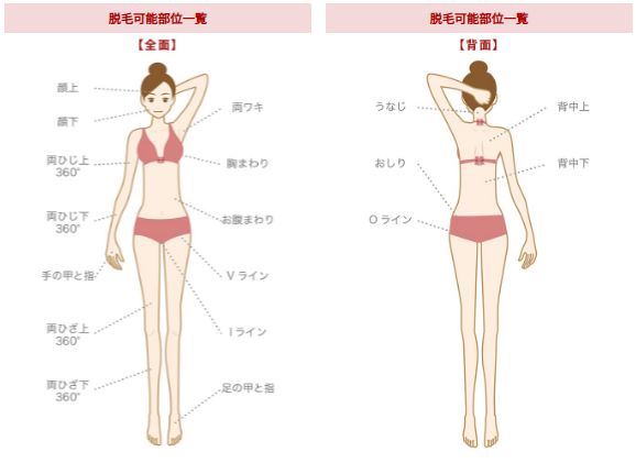 リンリンで脱毛できる顔・VIOを含む全身脱毛部位