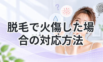 脱毛で火傷した場合の対応方法