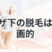 【潜在毛の期間も考慮！】ヒザ下の脱毛は計画的に